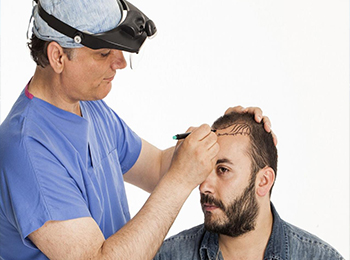 HAIR TRANSPLANT PACKAGE